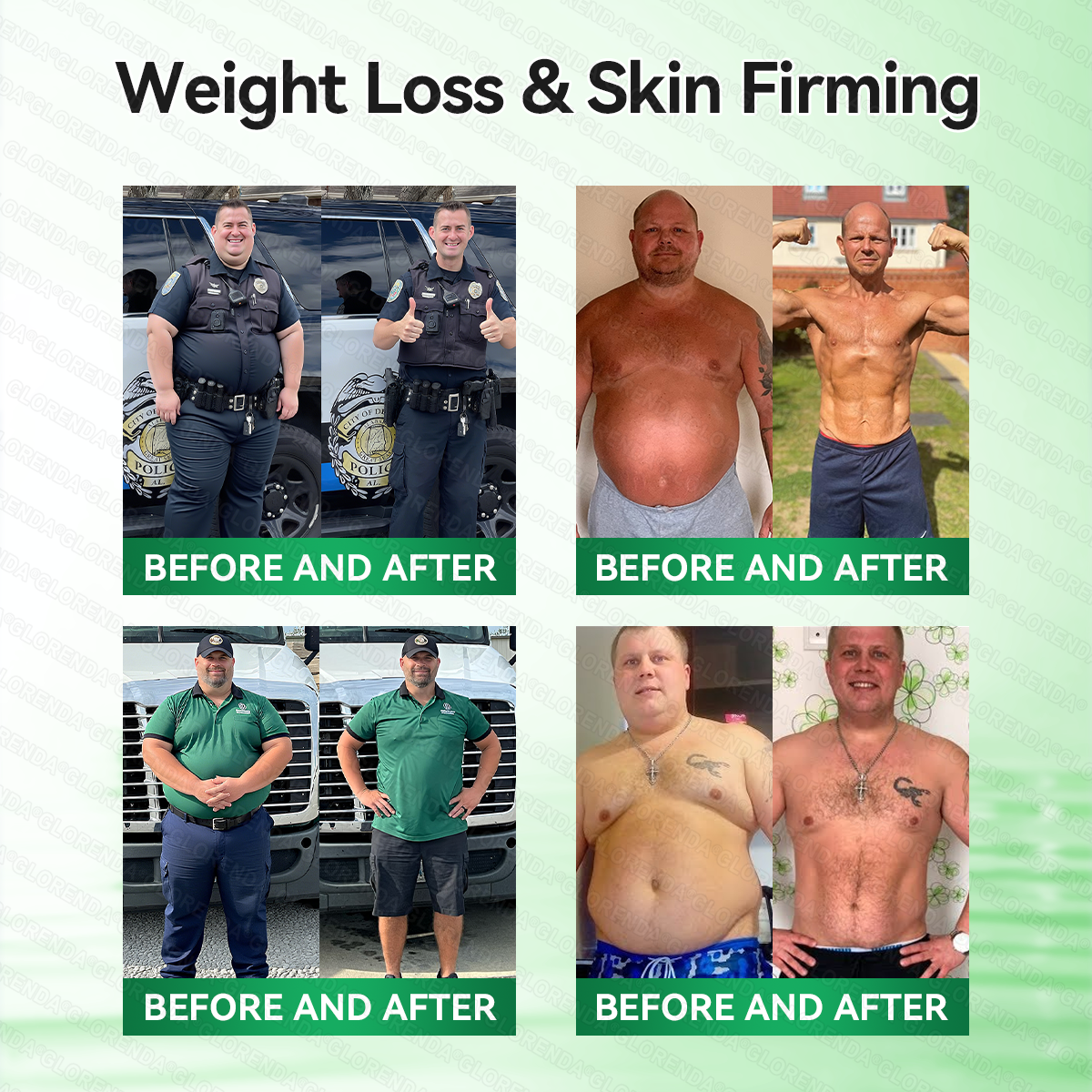 🇿🇦𝑶𝒇𝒇𝒊𝒄𝒊𝒂𝒍 𝑺𝒕𝒐𝒓𝒆 | 🍉𝐆𝑳𝑶𝗥𝗘𝗡𝘿𝘼® 𝙈𝒐𝒓𝒊𝒏𝒈𝗮 · 𝗕𝗲𝗿𝗯𝐞𝐫𝐢𝐧𝙚 × 𝙉𝑨𝑫+ 𝟏𝟎-𝙞𝙣-1 𝘼𝒅𝒗𝒂𝒏𝒄𝒆𝐝 𝐍𝐚𝐧𝙤 𝙈𝙞𝙘𝙧𝙤𝙣𝒆𝒆𝒅𝒍𝐞 𝐏𝐚𝐭𝙘𝙝(𝐉𝐮𝐬𝐭 𝐨𝐧𝐜𝐞 𝐚 𝐝𝐚𝐲, 𝐯𝐢𝐬𝐢𝐛𝐥𝐞 𝐜𝐡𝐚𝐧𝐠𝐞𝐬 𝐢𝐧 𝟕 𝐝𝐚𝐲𝐬） ✅ 𝐅𝐨𝐫 𝐨𝐛𝐞𝐬𝐢𝐭𝐲, 🅛🅞🅞🅢🅔 🅢🅚🅘🅝,𝐝𝐢𝐚𝐛𝐞𝐭𝐞𝐬, 𝐬𝐥𝐞𝐞𝐩 𝐚𝐩𝐧𝐞𝐚, 𝐣𝐨𝐢𝐧𝐭 𝐢𝐬𝐬𝐮𝐞𝐬, 𝐚𝐧𝐝 𝐦𝐨𝐫𝐞